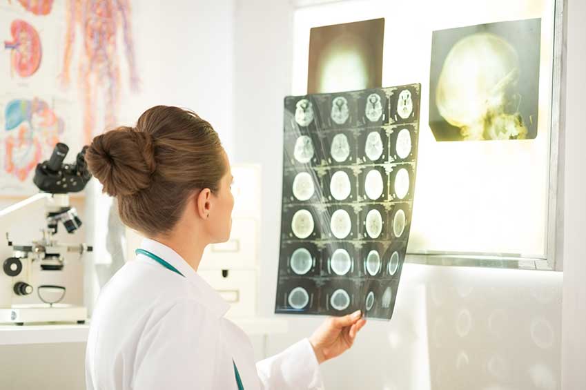 TBI In the Workplace – Still a Major Concern